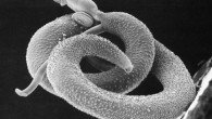 Helminths, commonly known as parasitic worms, infect one third of the world’s population, resulting in typically chronic and frequently deadly diseases. However, a clever parasite […]