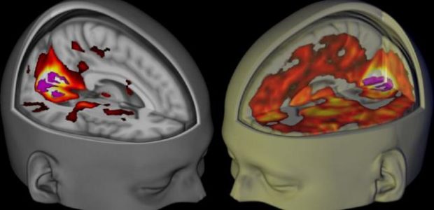 A team of scientists have visualised the human brain under the influence of LSD, lysergic acid diethylamide, for the first time ever in a recent […]