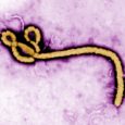 The notorious Ebola virus (EVD) is not a new disease, so why have many people only heard of it recently? Described in 1976 by Belgian […]