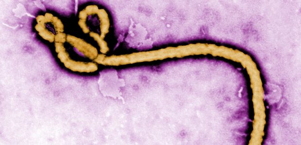 The notorious Ebola virus (EVD) is not a new disease, so why have many people only heard of it recently? Described in 1976 by Belgian […]